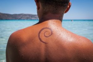 la rimozione tatuaggi durante l'estate è altamente sconsigliata perché la pelle potrebbe essere più sensibile all'esposizione dei raggi solari