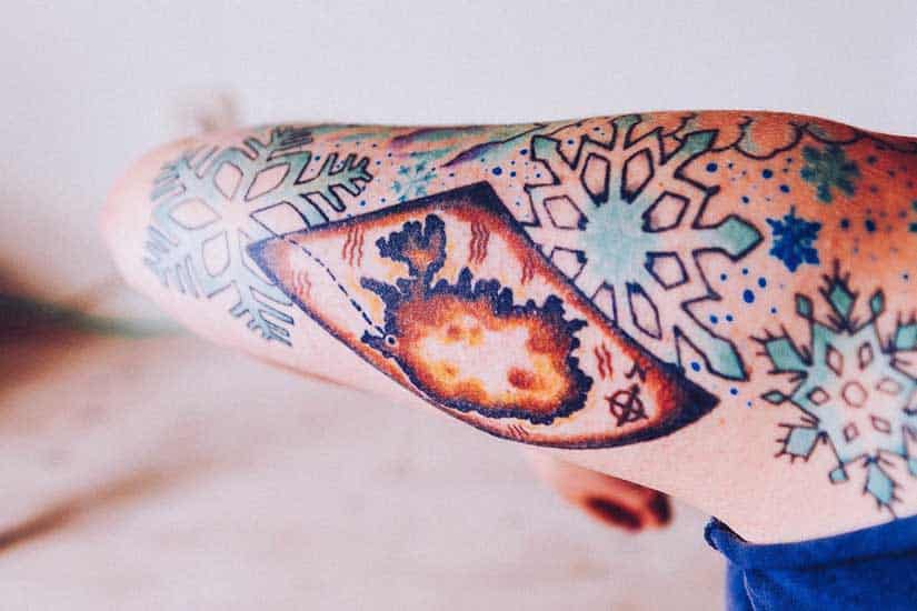 qual è la tecnologia laser migliore per la rimozione tatuaggi?