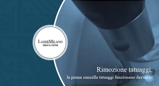 rimozione tatuaggi con penne rimuovi tatuaggi