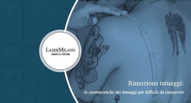 rimozione tatuaggi: quali sono quelli più difficili da eliminare