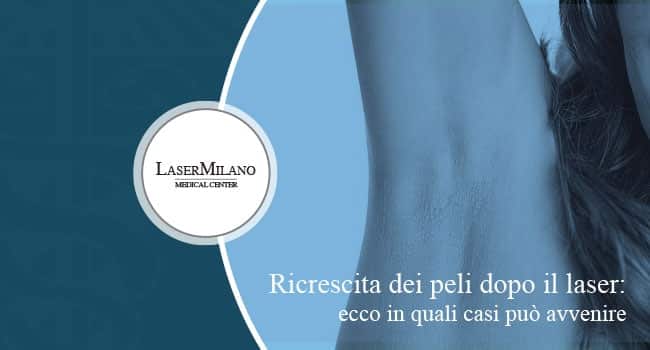 peli caduti dopo laser ricrescono | LaserMilano