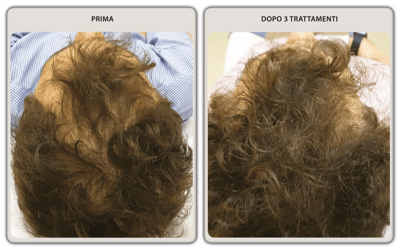 prima-dopo-uomo-04