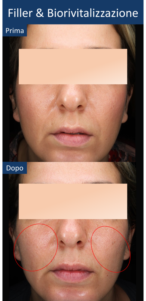 diapo15