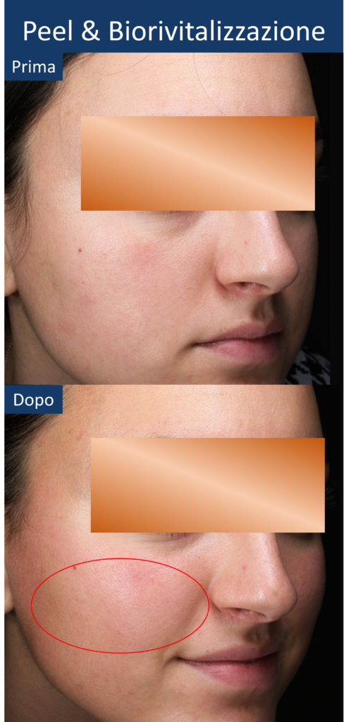 diapo16