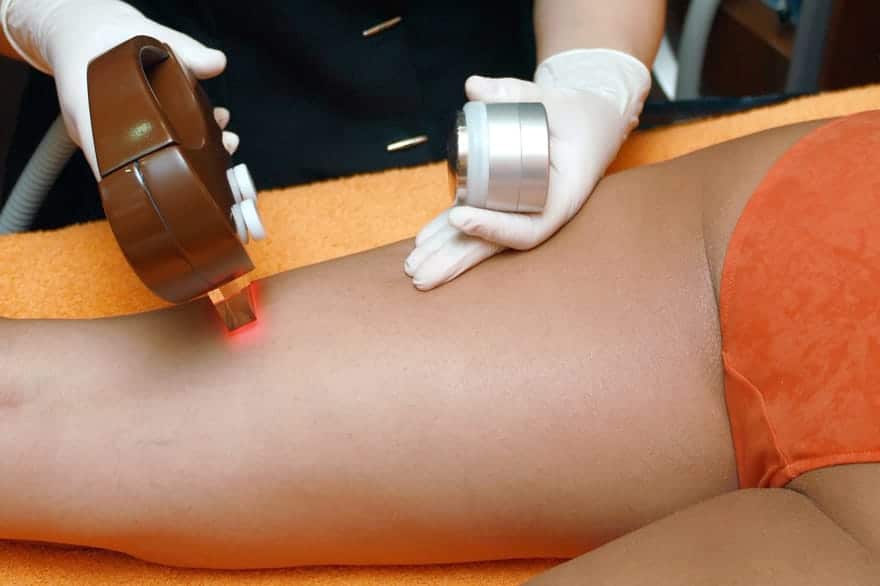 Intervallo ideale tra le sedute di epilazione laser | Laser Milano