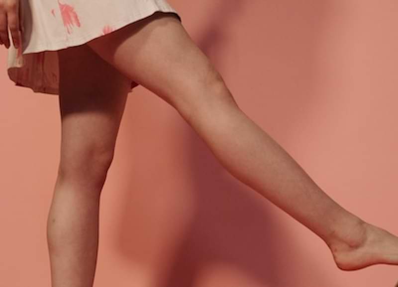 Perché evitare epilazione laser a casa | LaserMilano