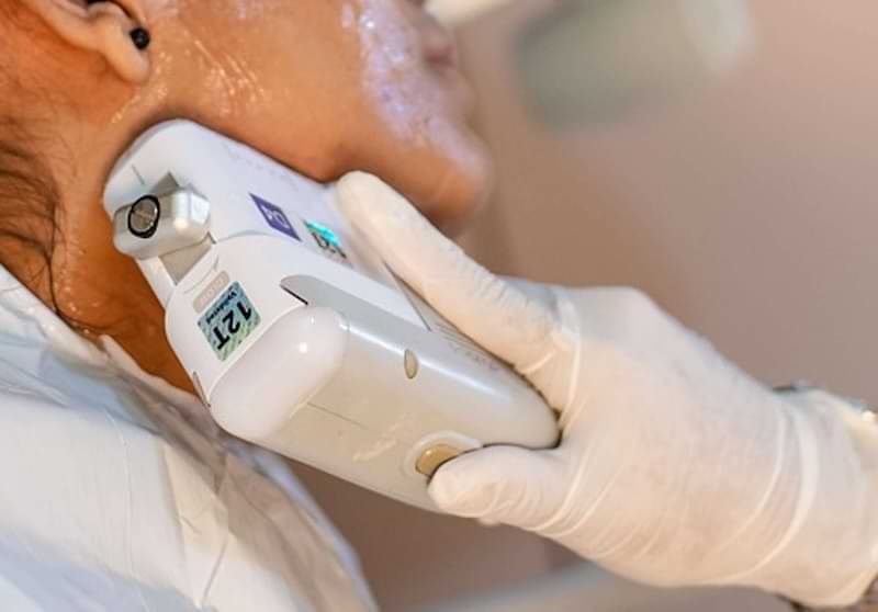 Rischi associati al laser fatto in casa | Laser Milano