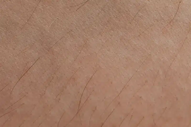 Peluria rada, primo piano | Laser Milano