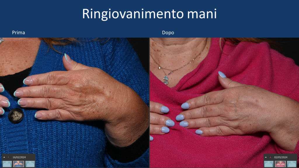 Mani-prima-e-dopo-s