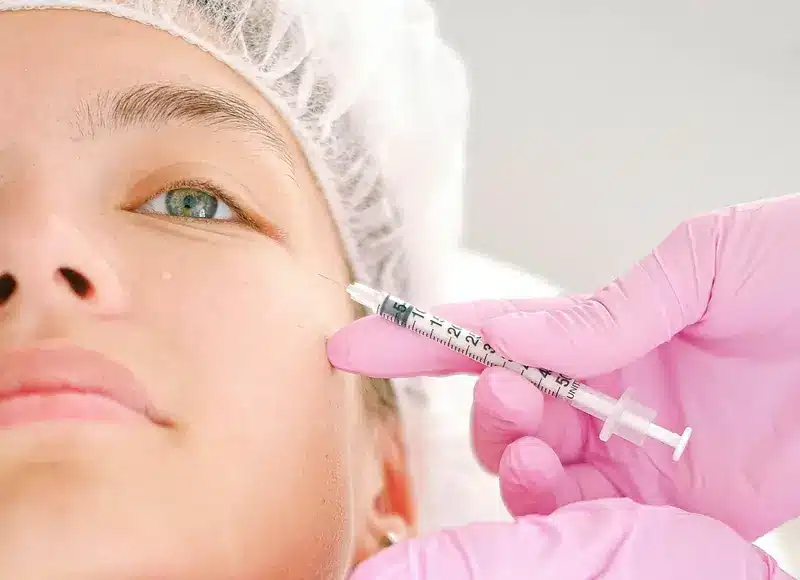 Trattamento con tossina botulinica in giovane donna | LaserMilano