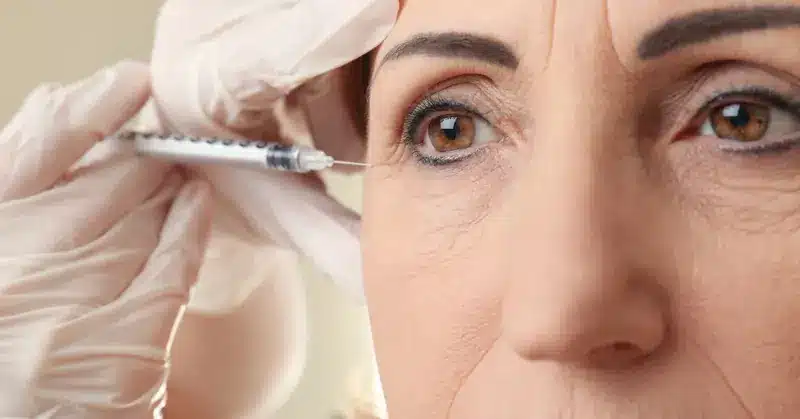 Primo piano occhio di donna con microiniezione | Laser Milano
