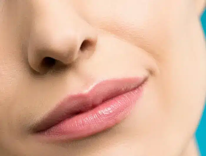 Rinofiller: immagine evocativa | LaserMilano