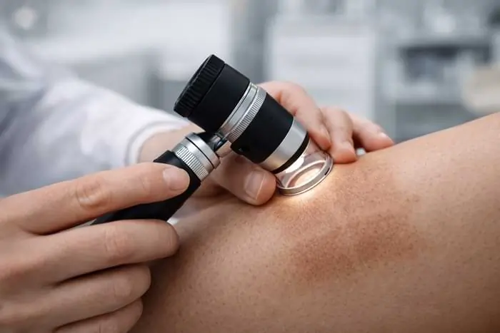 Valutazione dermatologica delle macchie da luce pulsata con dermatoscopio | Laser Milano