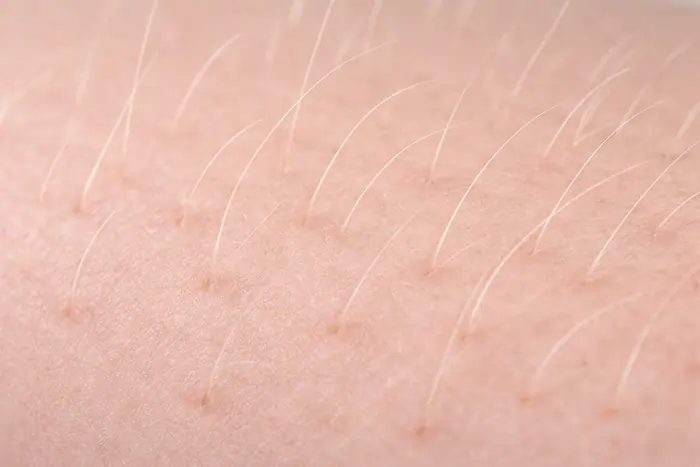 Finalmente la verità: il laser per i peli biondi funziona davvero? | Laser Milano