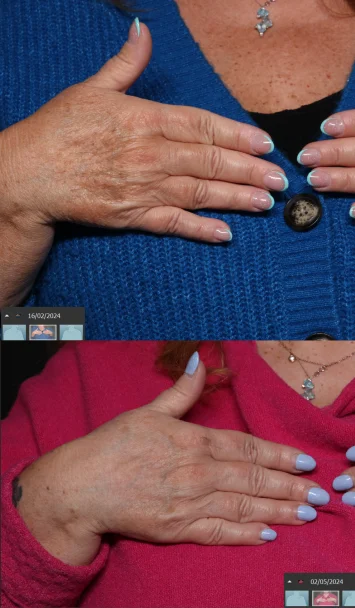 Mani-prima-e-dopo-vert-d