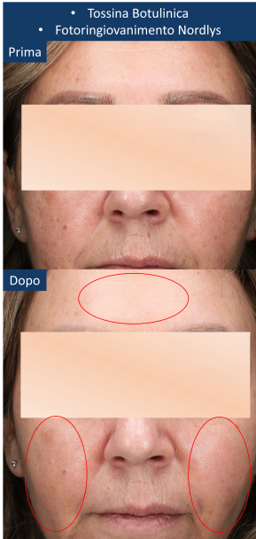 diapo2